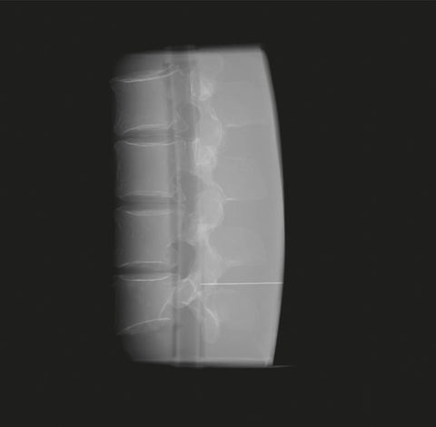 Fantomă de antrenament fluoroscopic pentru coloana lombară