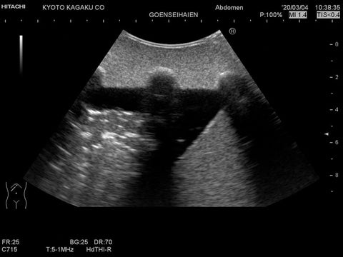 Fantomă antrenament ultrasunete pulmonară