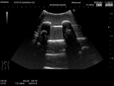 Fantomă antrenament ultrasunete pulmonară