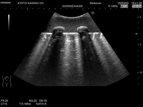 Fantomă antrenament ultrasunete pulmonară