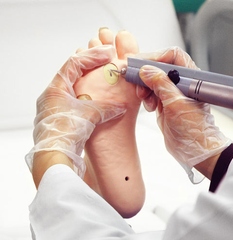 Model pentru îngrijire medicală a piciorului