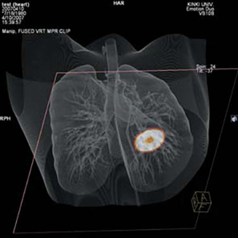 Fantomă toracică pentru radiografie și CT