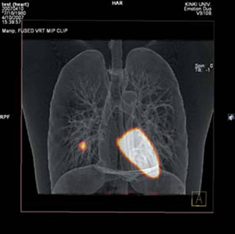 Fantomă toracică pentru radiografie și CT