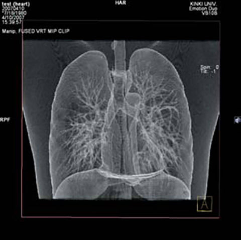 Fantomă toracică pentru radiografie și CT