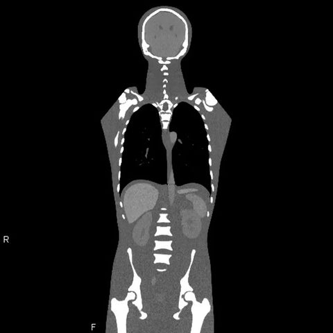 Fantomă CT torso