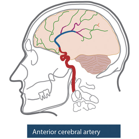 Model de cap angiografic
