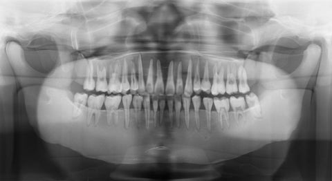 Fantomă cap pentru radiografie dentară, maxilare închise