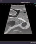 Fantomă de ultrasunete abdominale intraoperatorie și laparoscopice