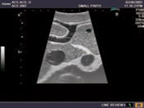 Fantomă de ultrasunete abdominale intraoperatorie și laparoscopice