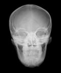 Fantomă radiografică secțională cu oase artificiale - Fantomă cap, transparentă