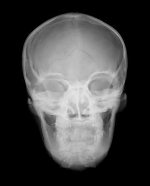 Fantomă radiografică secțională cu oase artificiale - Fantomă cap, transparentă