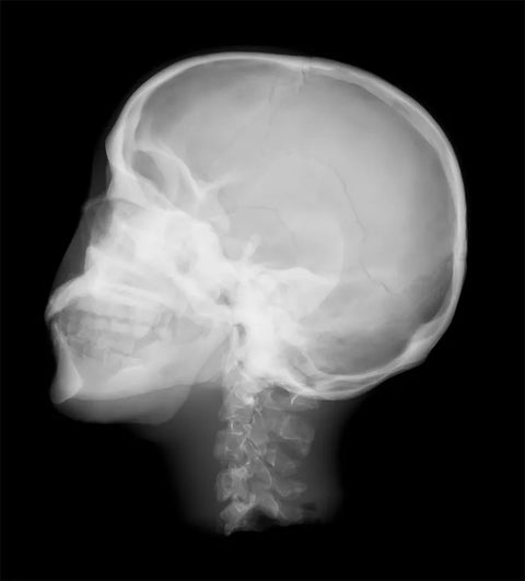Fantomă radiografică secțională cu oase artificiale - Fantomă cap, transparentă