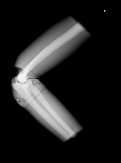 Fantomă radiografică secțională cu oase artificiale - Cot drept, opac