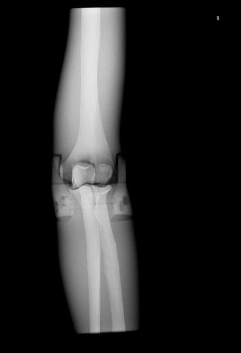 Fantomă radiografică secțională cu oase artificiale - Cot drept, opac