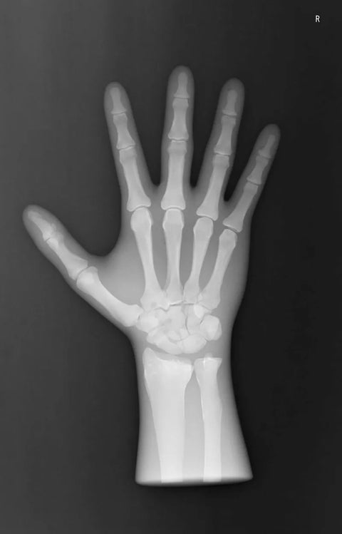Fantomă radiografică secțională cu oase artificiale - Mână dreaptă, opacă