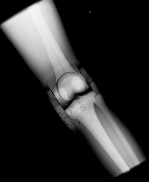 Fantomă radiologică secțională cu oase artificiale - Genunchi drept, opac