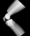 Fantomă radiologică secțională cu oase artificiale - Genunchi drept, opac