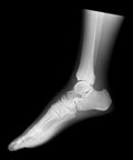 Fantomă radiografică secțională cu oase artificiale - Picior stâng, transparentă