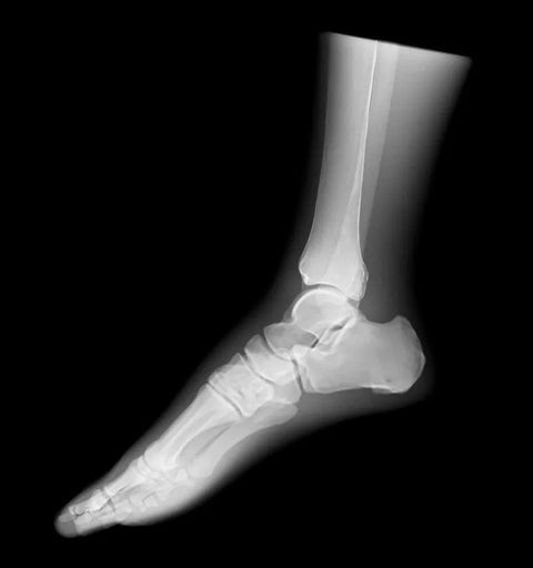 Fantomă radiografică secțională cu oase artificiale - Picior stâng, transparentă