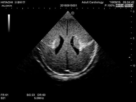 Fantomă cap neonatal pentru ecografie