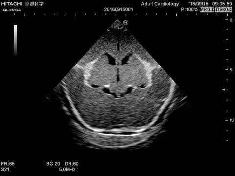 Fantomă cap neonatal pentru ecografie