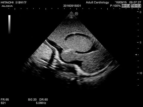 Fantomă cap neonatal pentru ecografie