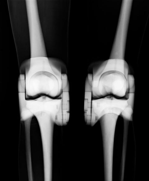 Fantomă pentru poziționare radiografică a întregului corp