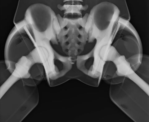 Fantomă pentru poziționare radiografică a întregului corp