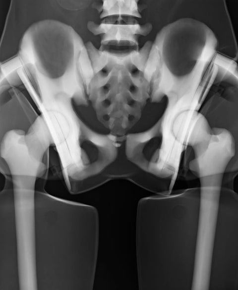Fantomă pentru poziționare radiografică a întregului corp