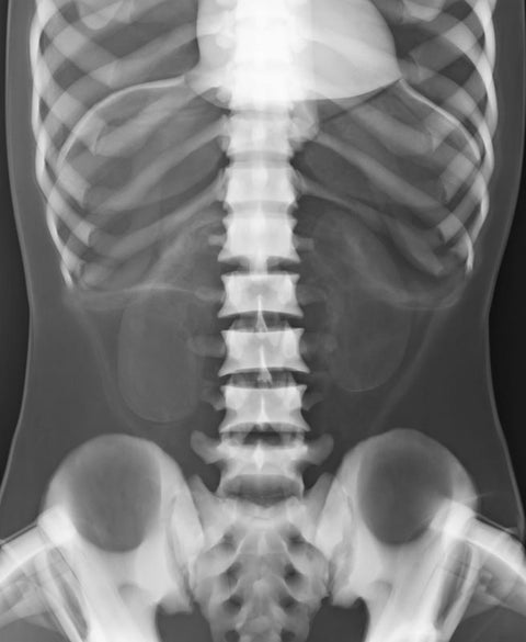 Fantomă pentru poziționare radiografică a întregului corp