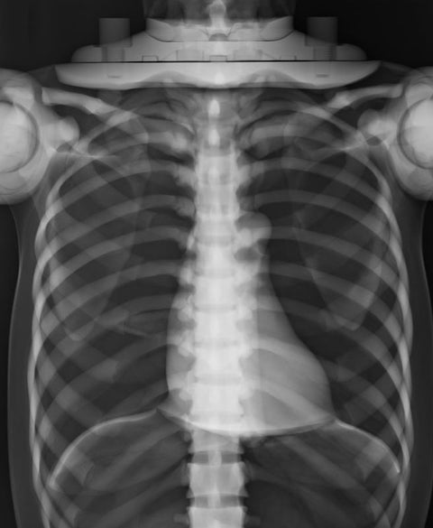 Fantomă pentru poziționare radiografică a întregului corp