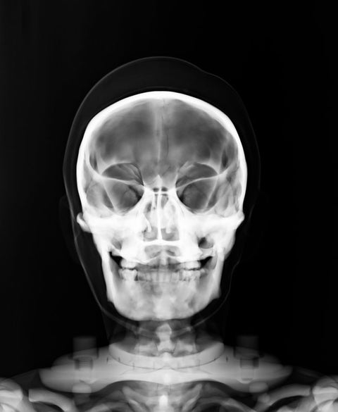 Fantomă pentru poziționare radiografică a întregului corp