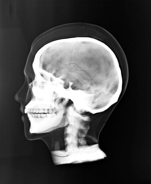 Fantomă pentru poziționare radiografică a întregului corp