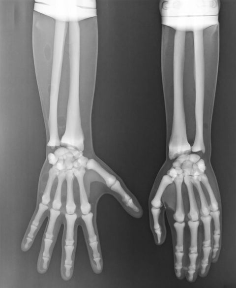 Fantomă pentru poziționare radiografică a întregului corp