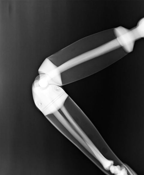 Fantomă pentru poziționare radiografică a întregului corp