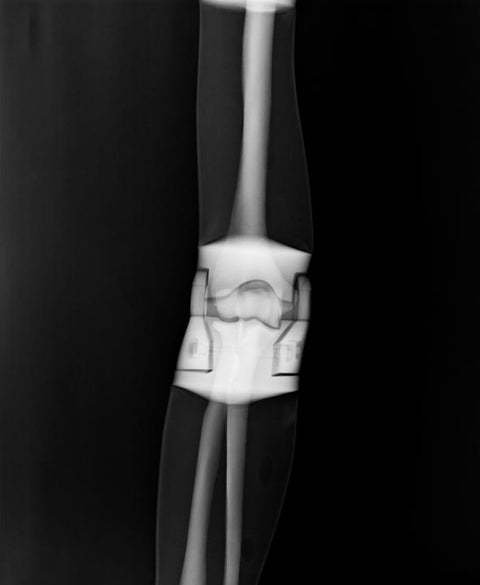 Fantomă pentru poziționare radiografică a întregului corp