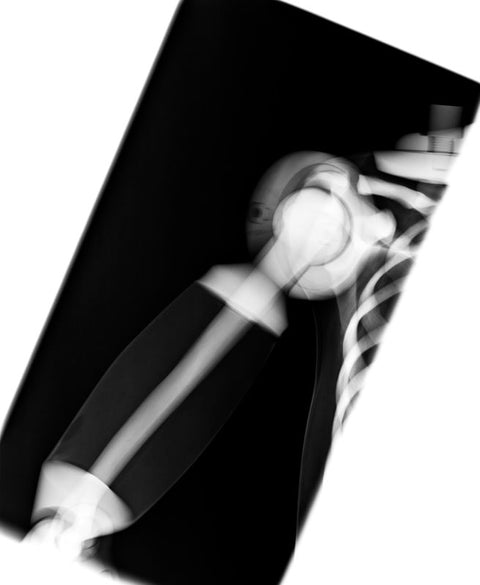 Fantomă pentru poziționare radiografică a întregului corp