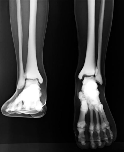 Fantomă pentru poziționare radiografică a întregului corp