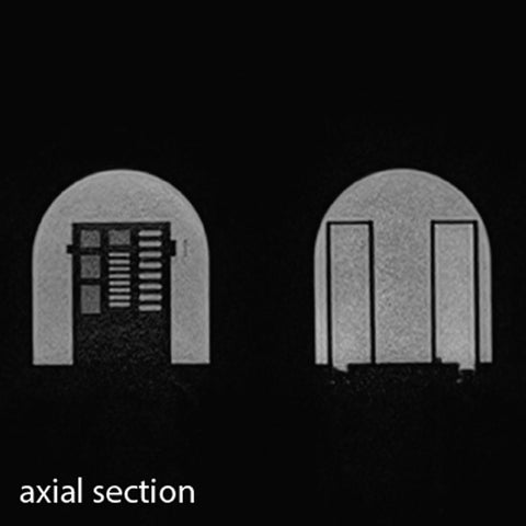 Fantomă MRI QA pentru sân