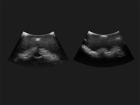 Simulator de injecție epidurală-spinală GENESIS
