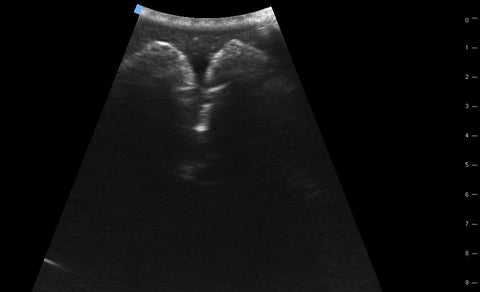 SonoEZ simulator de ultrasonografie "Vezica urinară"
