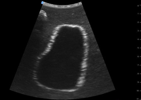SonoEZ simulator de ultrasonografie "Vezica urinară"