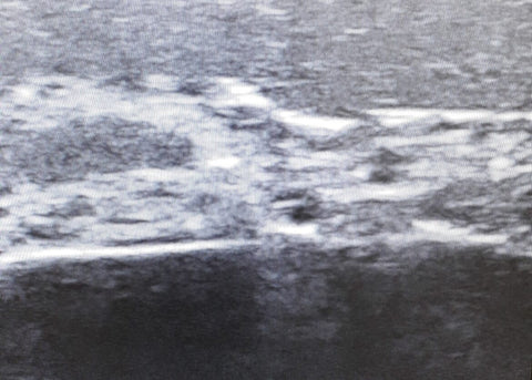 Ultrasound Training Face