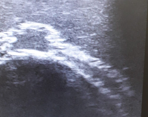 Ultrasound Training Face