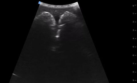 SonoEZ simulator de ultrasonografie "Vezica urinară"