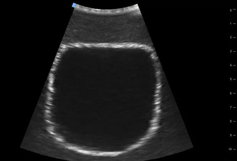 SonoEZ simulator de ultrasonografie "Vezica urinară"