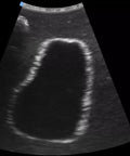SonoEZ simulator de ultrasonografie "Vezica urinară"