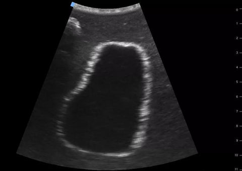 SonoEZ simulator de ultrasonografie "Vezica urinară"