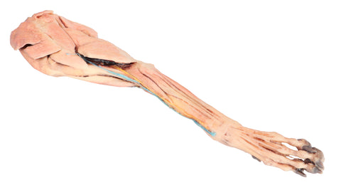 Membrul anterior al câinelui – mușchi, tendoane, ligamente, vase și nervi distal de cot
