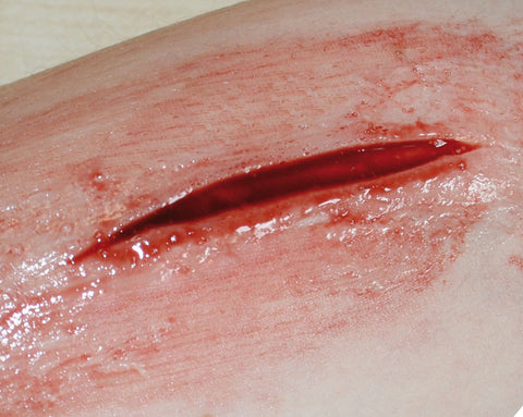 EZ wounds - set de simulare caz de bază